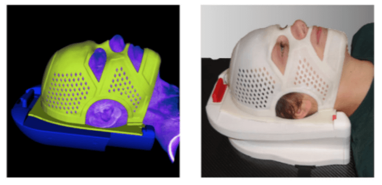 3D Fabrication Fixation Devices for Radiotherapy Procedures-1