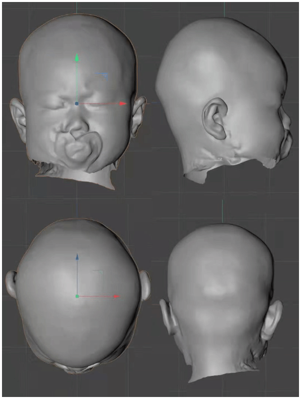 Analysis, measurement of head structure